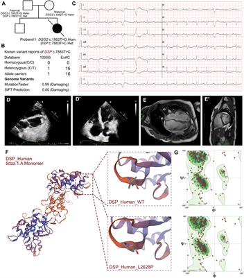 Case report: Additional variants induced sudden cardiac death among pediatric ACM with DSG2 homozygous mutant genotype: a report of three cases
